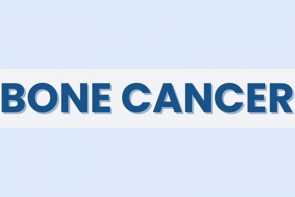 Bone Cancer Fact Sheet: Symptoms, Causes, Treatment