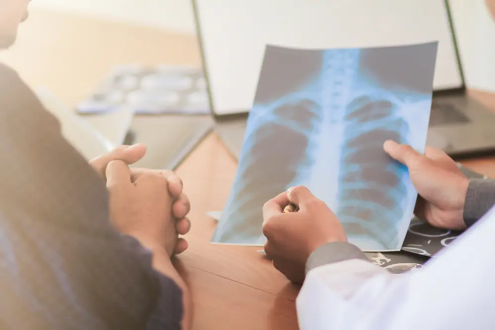 Longevity in Lung Cancer: The New Standard