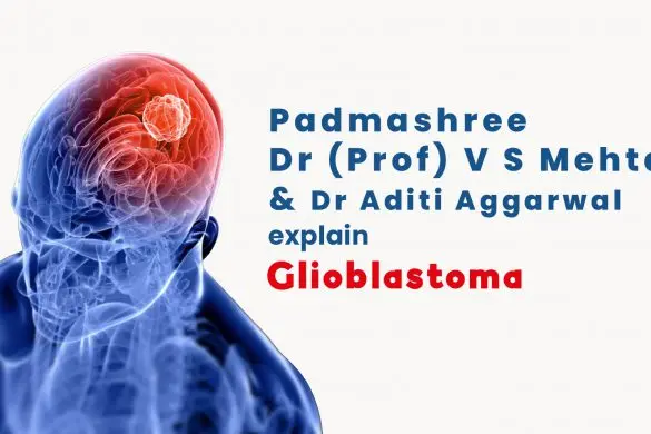 Glioblastoma Simplified: Understanding its Symptoms and Treatment Options