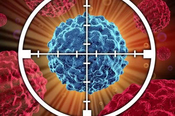 What Are the New Advancements in the Treatment of Lung Cancer?