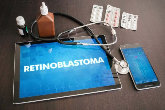 What is Retinoblastoma? Everything you Need to Know