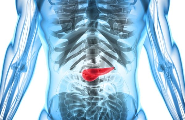 How is Pancreatic Cancer Treated?