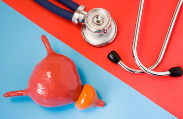 8 Things You Need To Know About Bladder Cancer