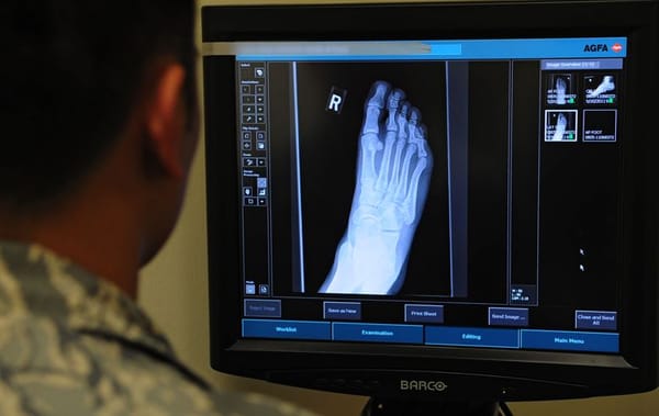 Will A Bone Tumour Kill You?