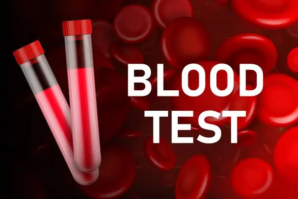 Blood Tests for Cancer: Tumour Markers Explained